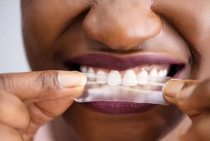 should you brush your teeth after whitening strips